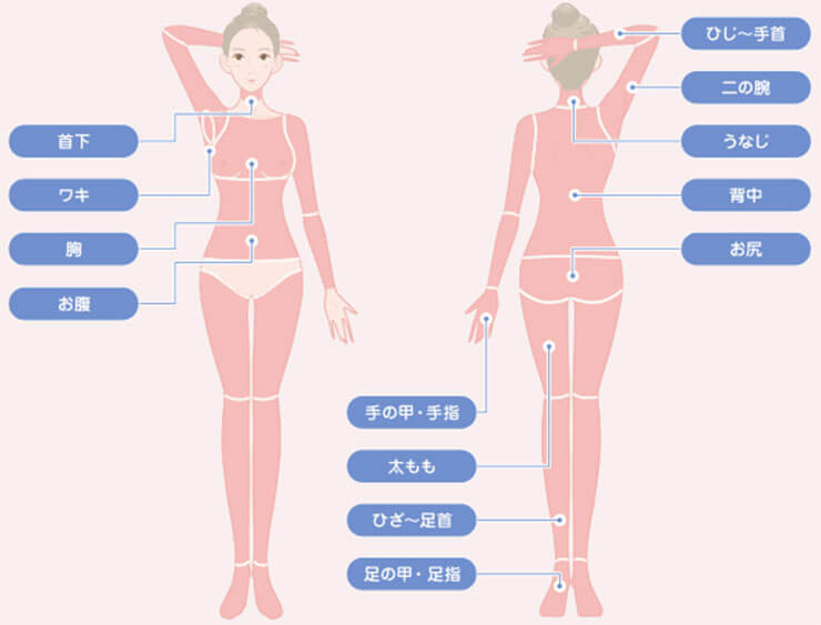 TCB東京中央美容外科の全身医療脱毛の施術範囲